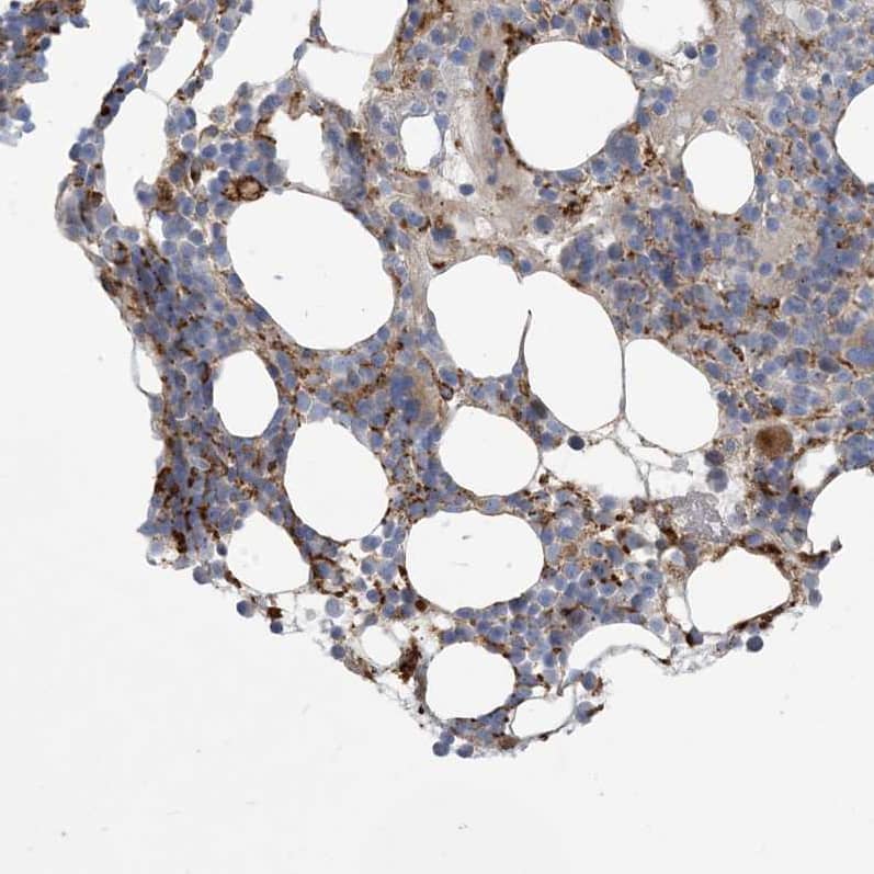 Staining of human bone marrow shows moderate membranous positivity in hematopoietic cells.