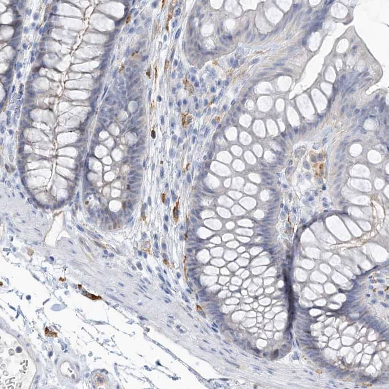 Staining of human colon shows no membranous positivity in glandular cells as expected.
