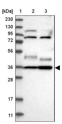 Lane 1: Marker [kDa] 230, 130, 95, 72, 56, 36, 28, 17, 11Lane 2: Human cell line RT-4Lane 3: Human cell line U-251MG sp