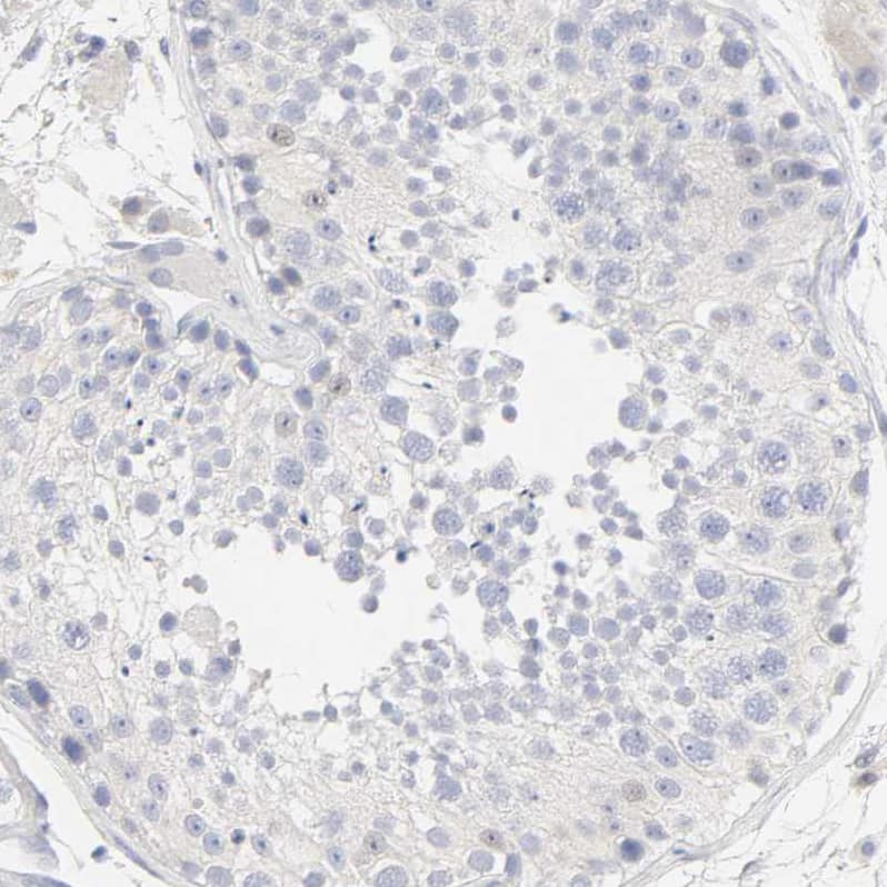 Immunohistochemistry FCGBP Antibody - BSA Free