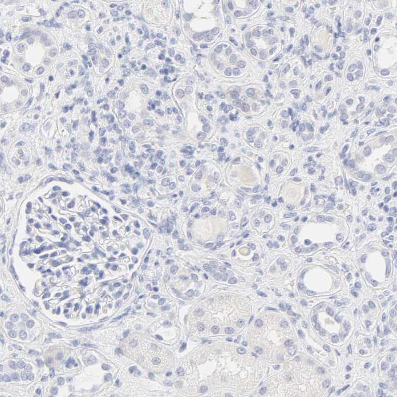Immunohistochemistry FCGBP Antibody - BSA Free