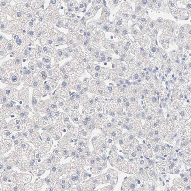 Immunohistochemistry FCGBP Antibody - BSA Free