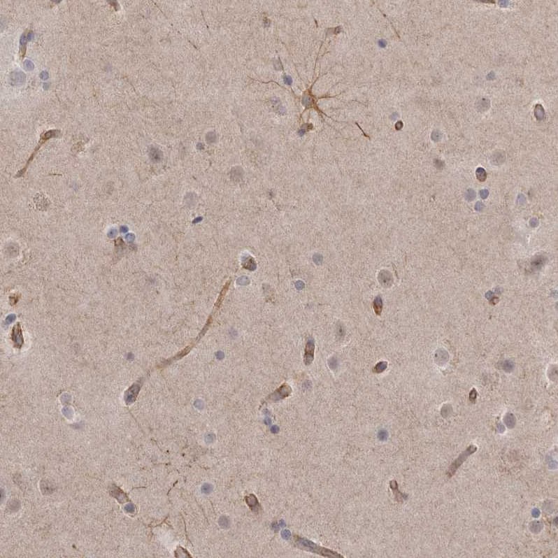 Staining of human cerebral cortex shows moderate cytoplasmic positivity in glial cells.