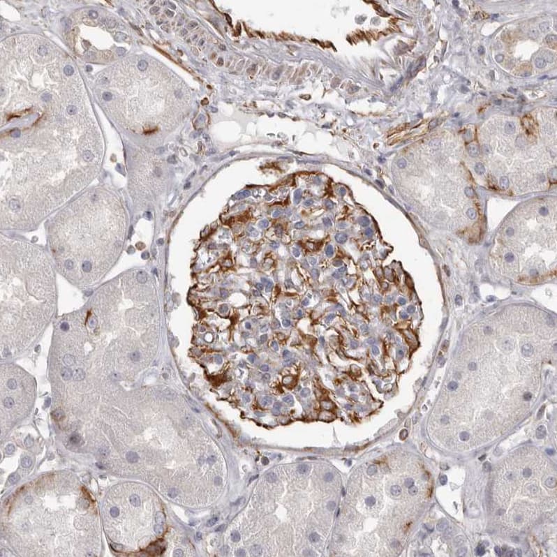 Staining of human kidney shows strong cytoplasmic positivity in cells in glomeruli.