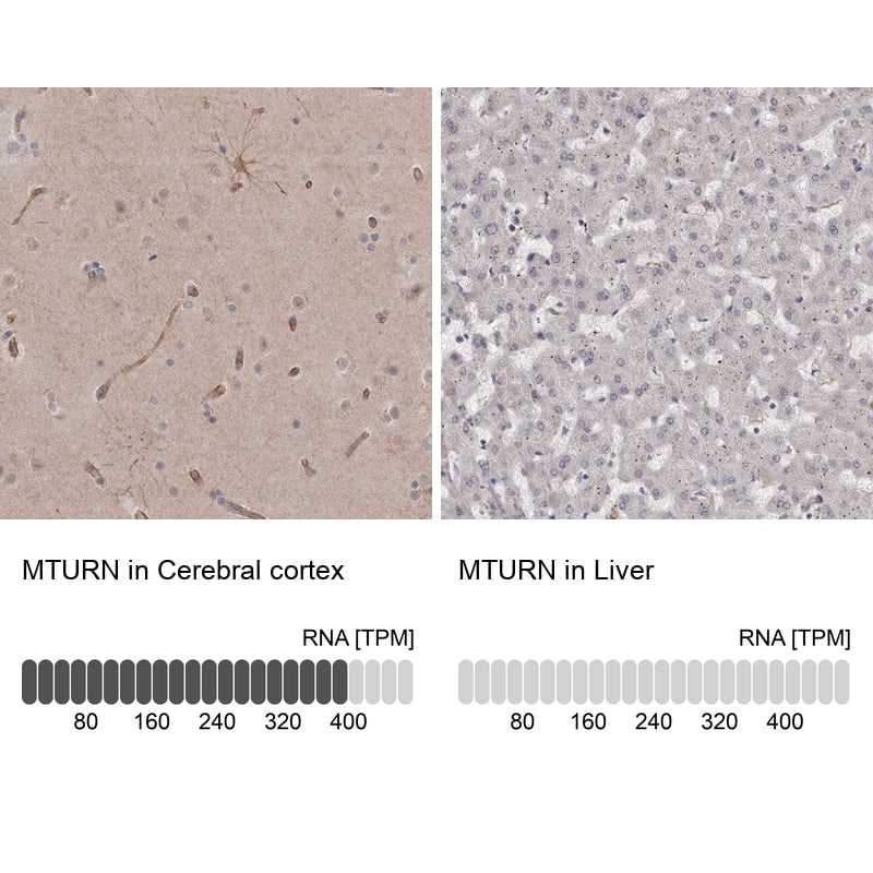 Analysis in human cerebral cortex and liver tissues using NBP1-90477 antibody. Corresponding MTURN RNA-seq data are presented for the same tissues.