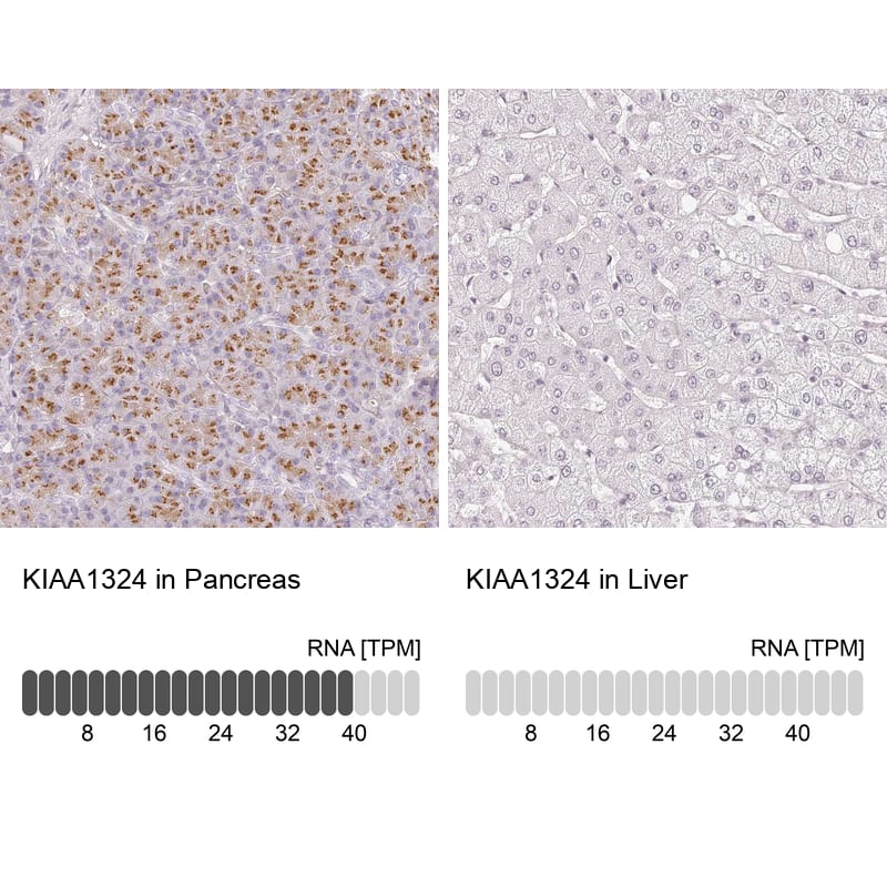 Analysis in human pancreas and liver tissues using NBP1-90479 antibody. Corresponding KIAA1324 RNA-seq data are presented for the same tissues.