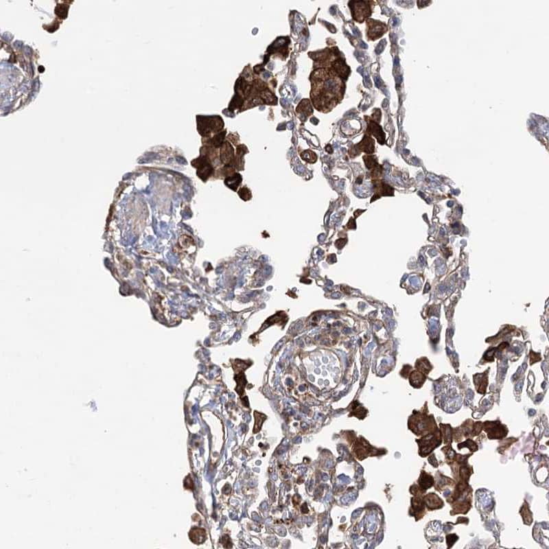 Immunohistochemistry-Paraffin OTUD1 Antibody - BSA Free