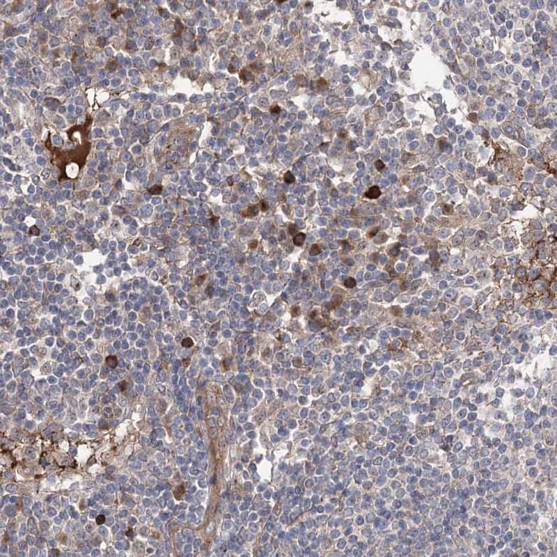 Staining of human lymph node shows moderate to strong cytoplasmic positivity in lymphoid cells.