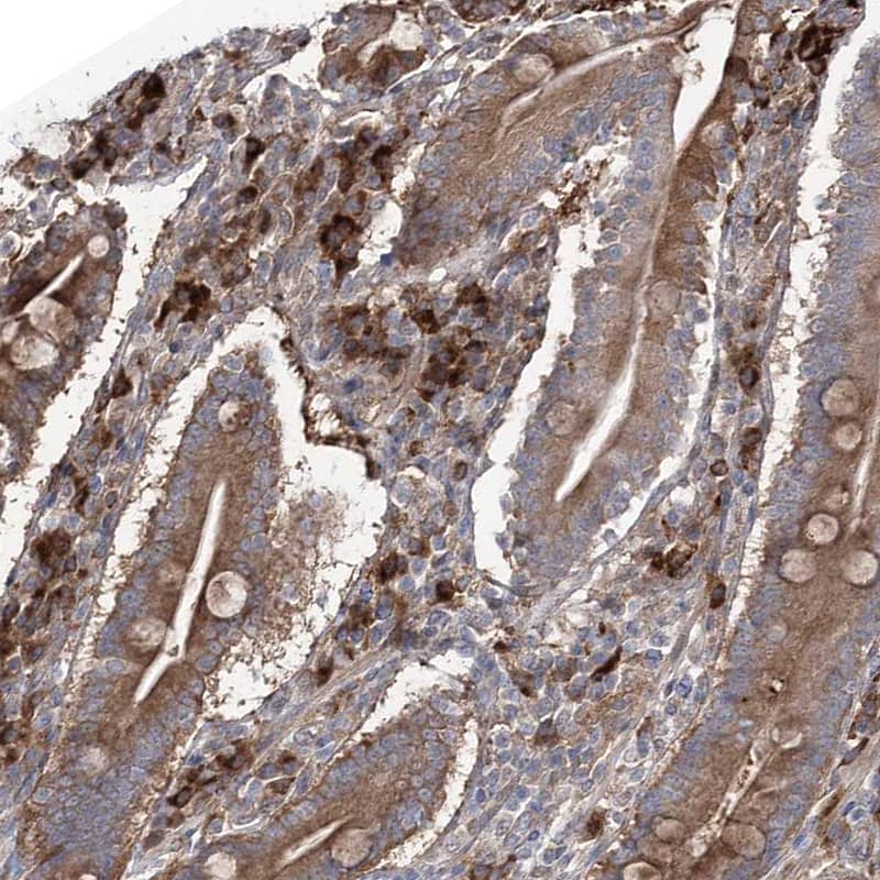 Staining of human duodenum shows moderate to strong cytoplasmic positivity in lymphoid cells.