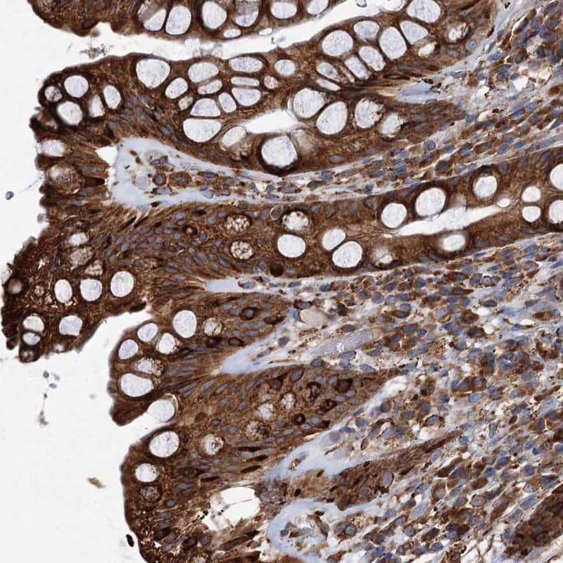 Staining of human rectum shows strong cytoplasmic positivity in glandular cells.