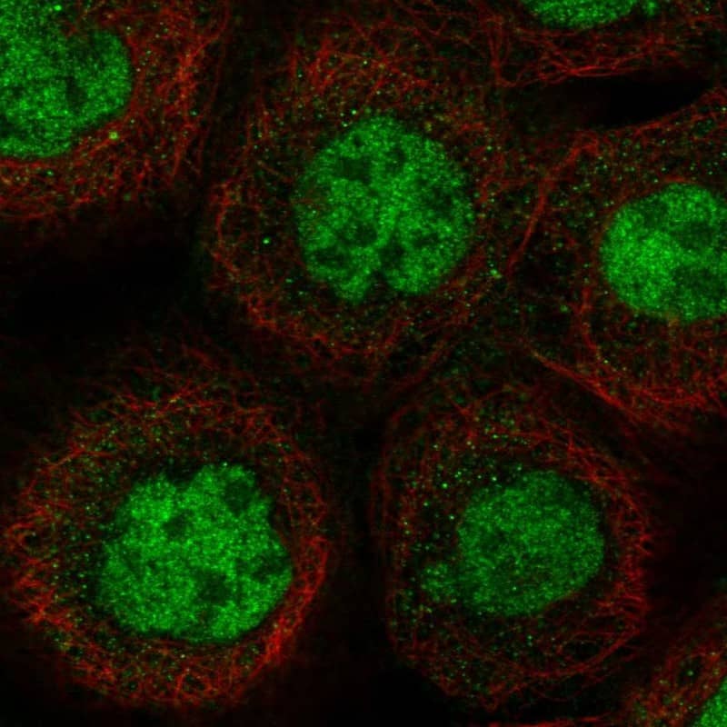 Staining of human cell line A-431 shows localization to nucleoplasm.