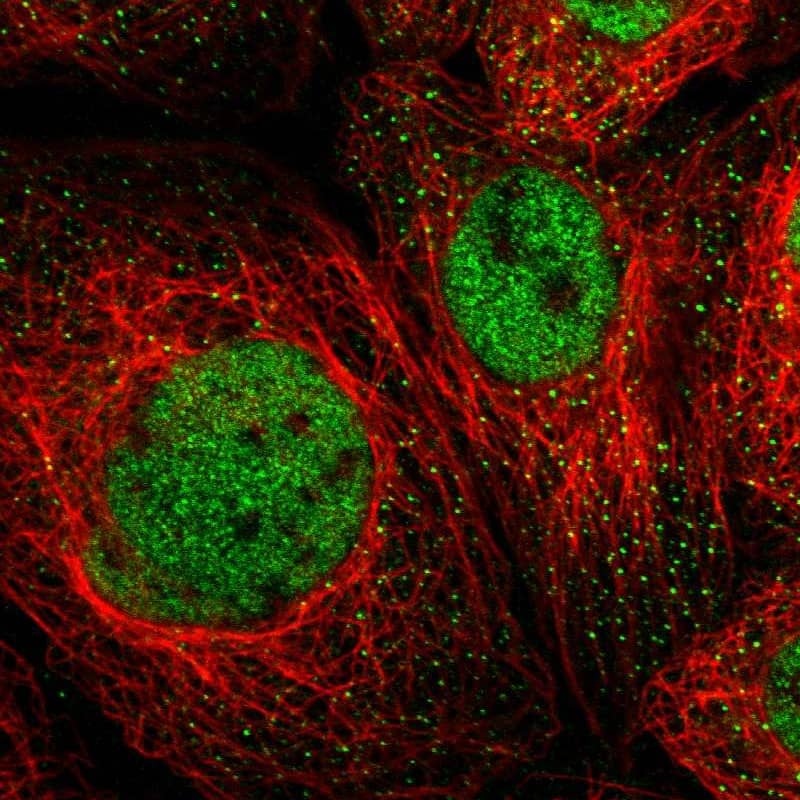 Staining of human cell line A-431 shows localization to nucleoplasm.
