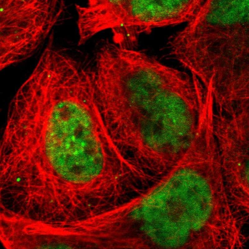 Staining of human cell line A-431 shows localization to nucleoplasm.