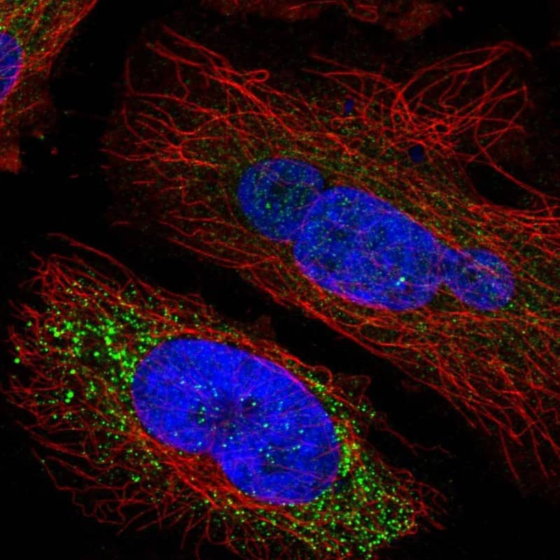 Staining of human cell line HeLa shows localization to vesicles.