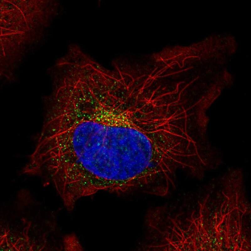 Staining of human cell line HeLa shows localization to vesicles.