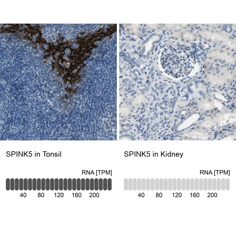 <b>Orthogonal Strategies Validation. </b>Analysis in human tonsil and kidney tissues using NBP1-90510 antibody. Corresponding SPINK5 RNA-seq data are presented for the same tissues.