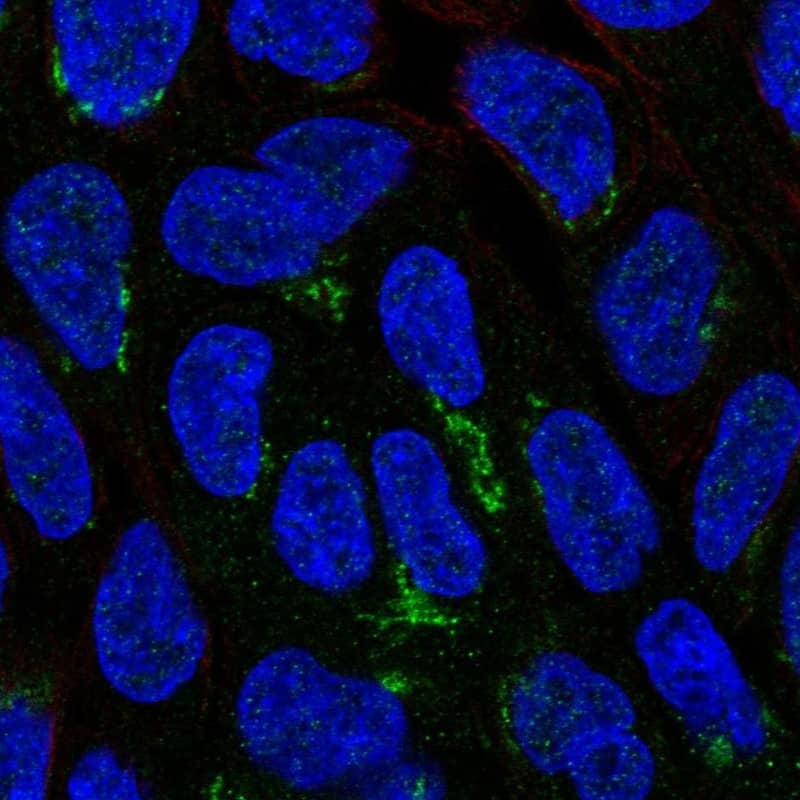 Staining of human cell line RT4 shows localization to the Golgi apparatus.