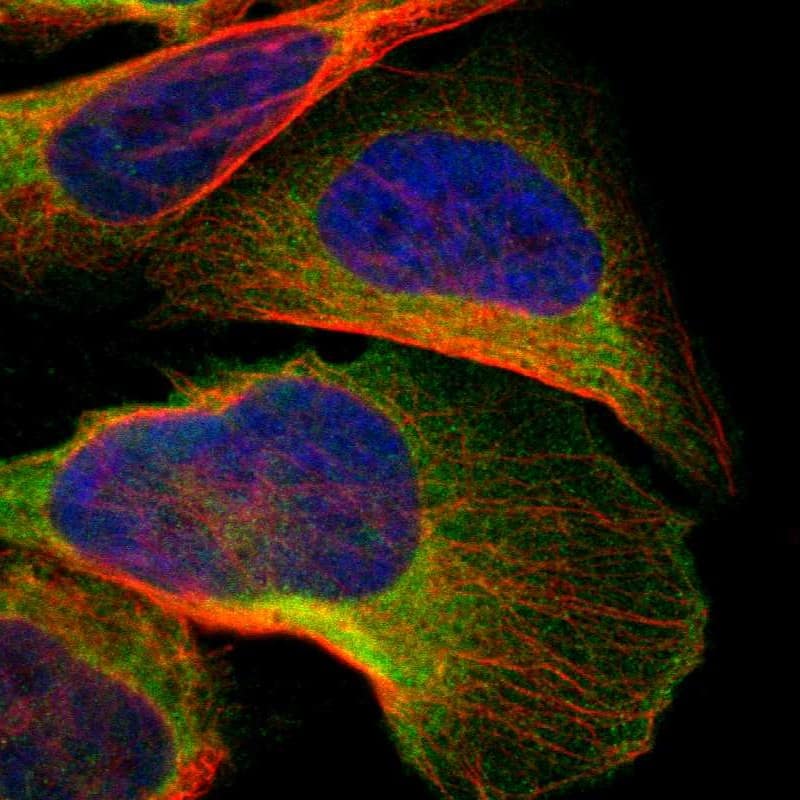 Staining of human cell line U-2 OS shows localization to cytosol.