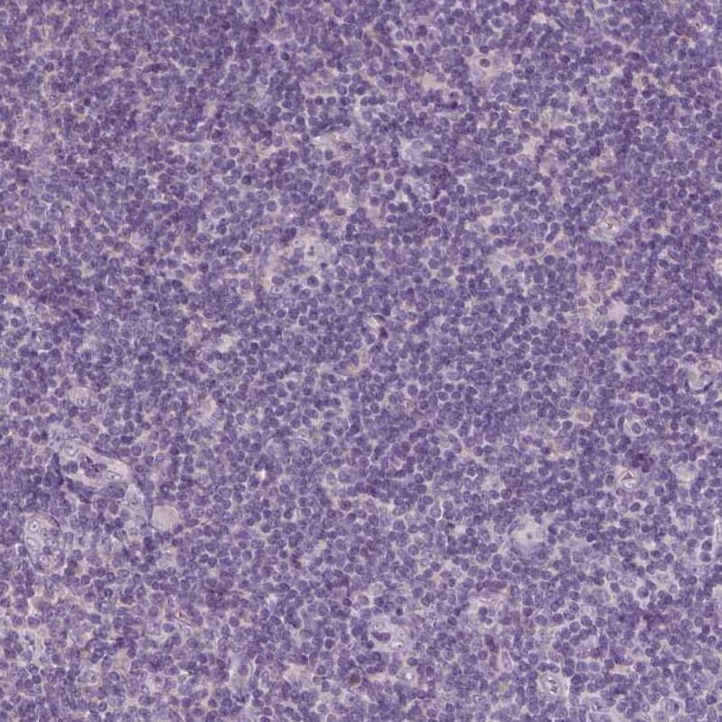 Immunohistochemistry-Paraffin FAM154B Antibody - BSA Free