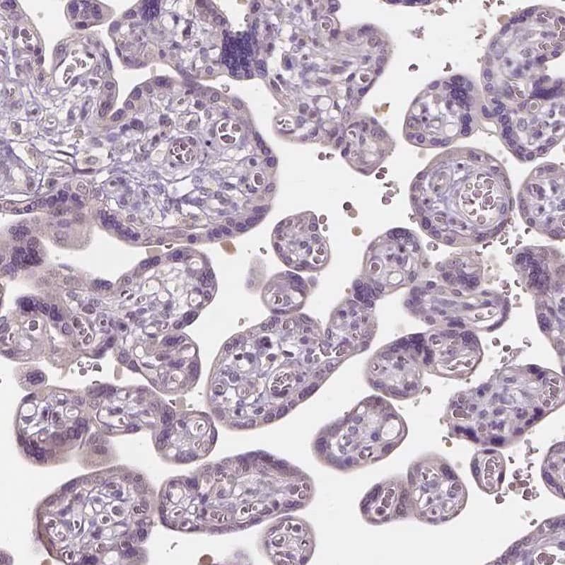 Immunohistochemistry-Paraffin FAM154B Antibody - BSA Free