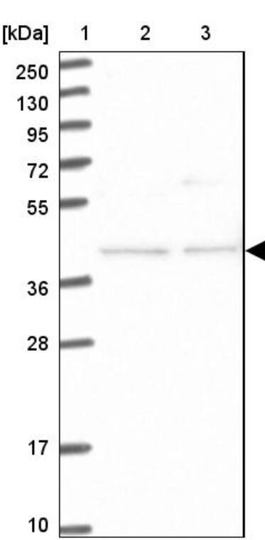 Lane 1: Marker [kDa] 250, 130, 95, 72, 55, 36, 28, 17, 10_br/_Lane 2: Human cell line RT-4_br/_Lane 3: Human cell line U-251MG sp