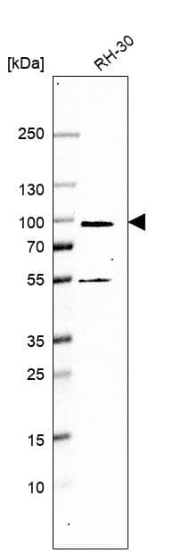 Analysis in human cell line RH-30.