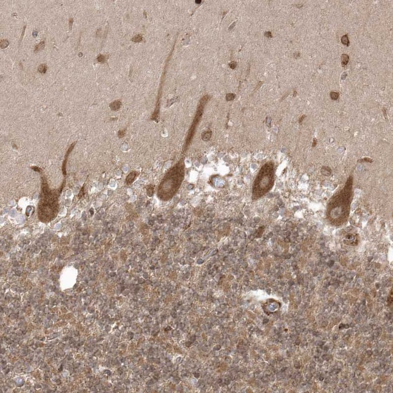 Staining of human cerebellum shows moderate cytoplasmic positivity in Purkinje cells.