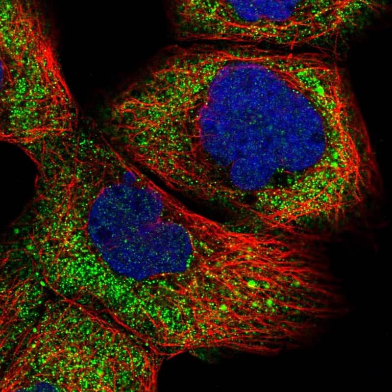 Immunocytochemistry/ Immunofluorescence R3HCC1 Antibody - BSA Free
