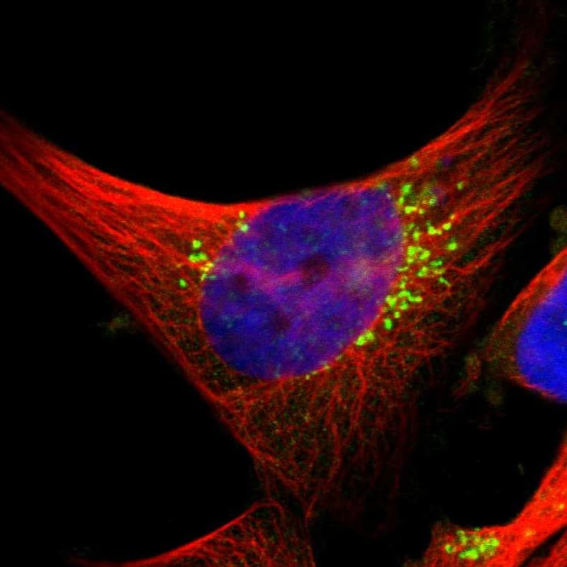 Staining of human cell line U-251 MG shows localization to the Golgi apparatus.