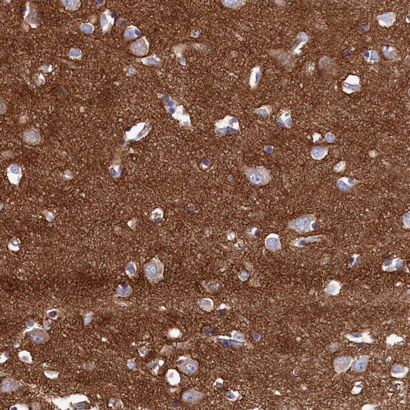 Staining of human cerebral cortex shows strong positivity in neuropil.
