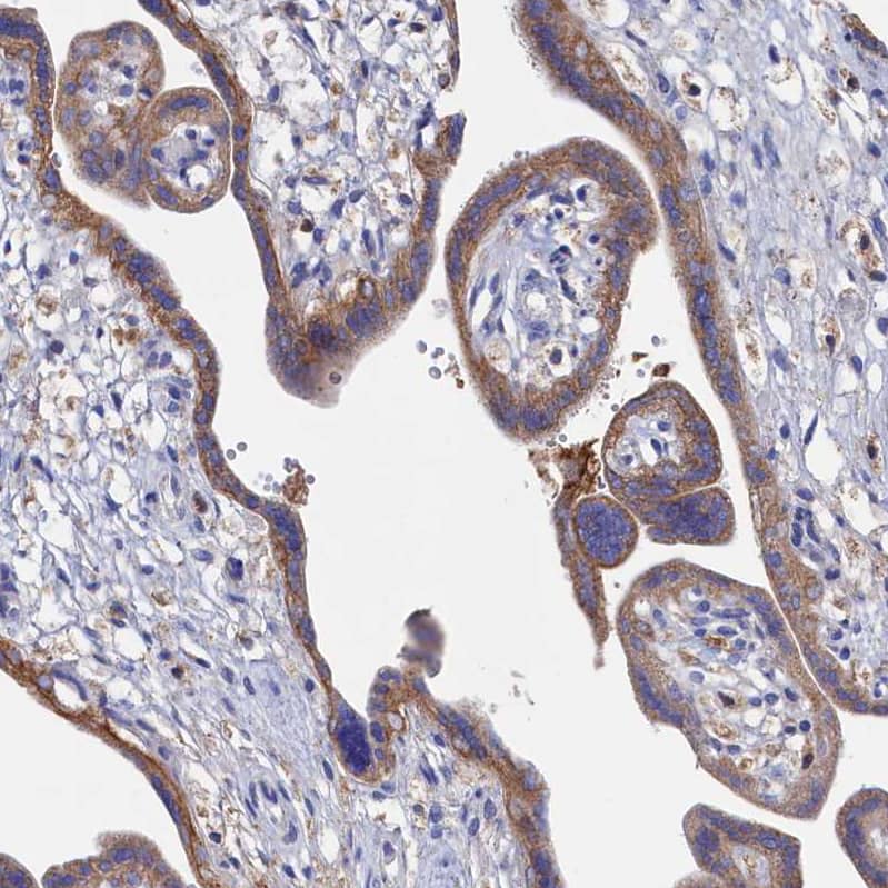 Staining of human placenta shows moderate cytoplasmic positivity in trophoblastic cells.