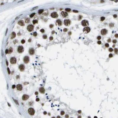 Immunohistochemistry-Paraffin NSRP1 Antibody - BSA Free