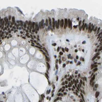 Immunohistochemistry-Paraffin NSRP1 Antibody - BSA Free