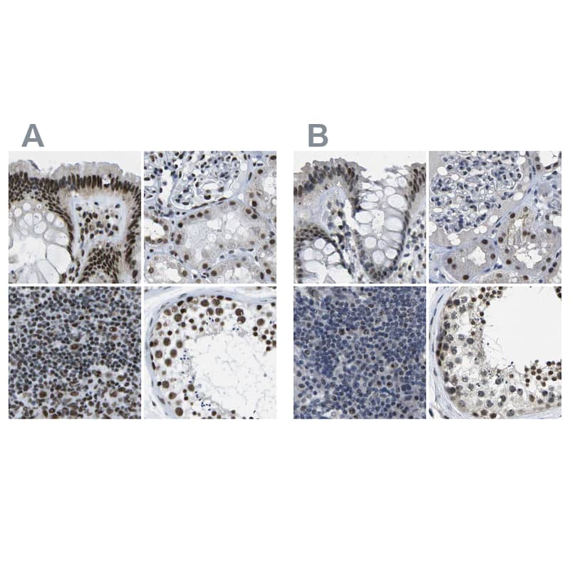 Immunohistochemistry-Paraffin NSRP1 Antibody - BSA Free