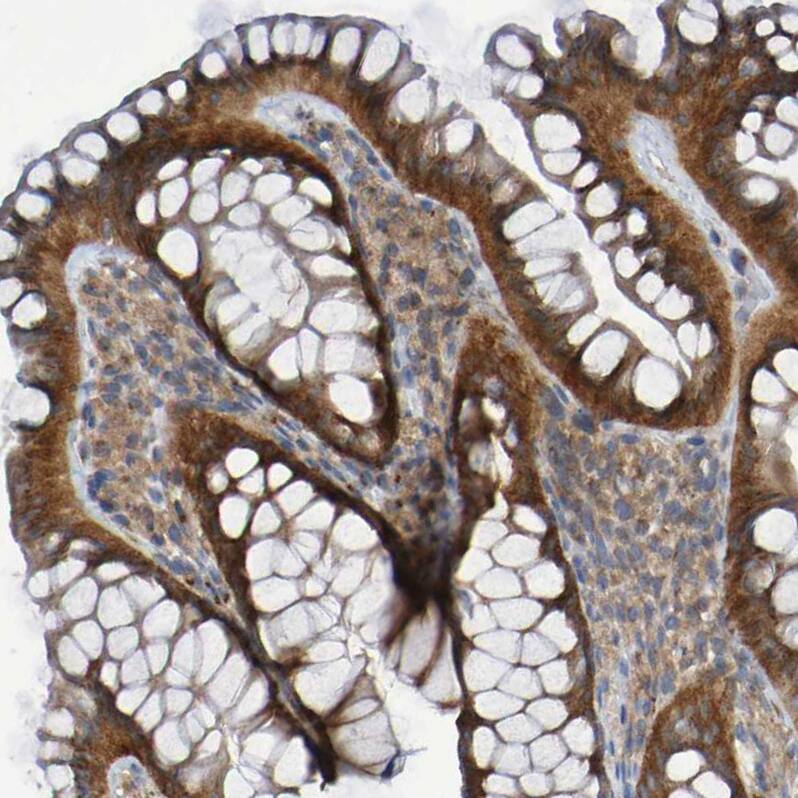 Immunohistochemistry LMBRD2 Antibody - BSA Free