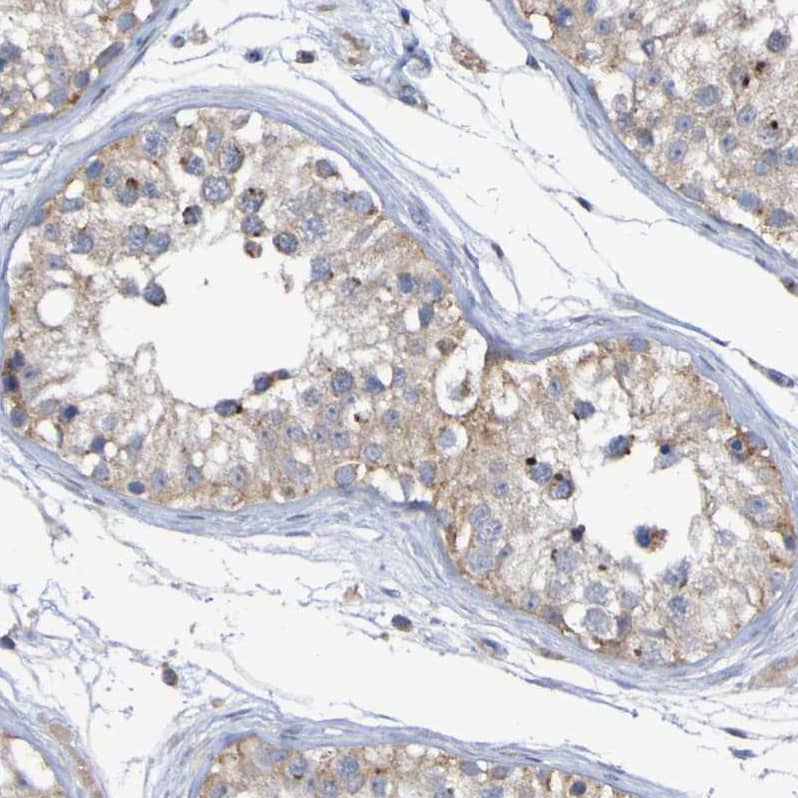 Immunohistochemistry LMBRD2 Antibody - BSA Free
