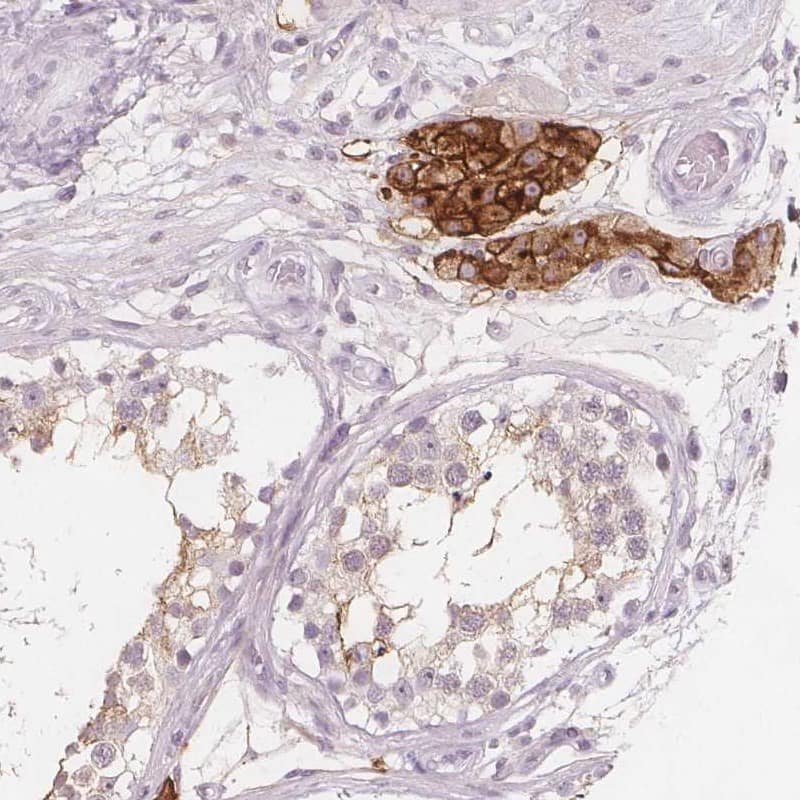 Staining of human testis shows strong membranous positivity in Leydig cells.