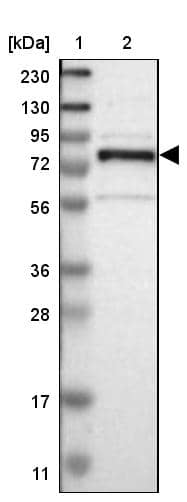 Lane 1: Marker [kDa] 230, 130, 95, 72, 56, 36, 28, 17, 11Lane 2: Human cell line RT-4