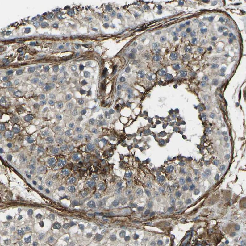 Staining of human testis shows moderate to strong membranous positivity in cells in seminiferous ducts.