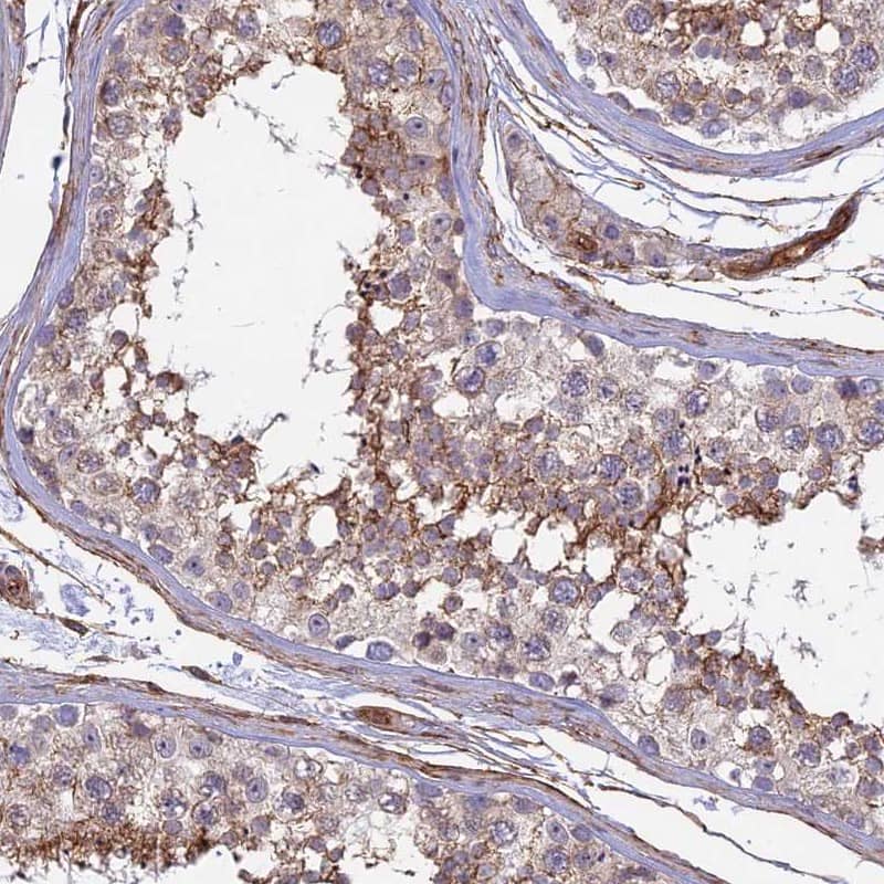 Immunohistochemistry CNBD2 Antibody - BSA Free