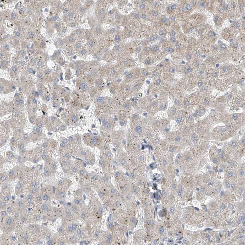 Staining of human liver shows low expression as expected.