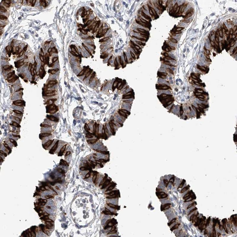 Staining of human fallopian tube shows high expression.