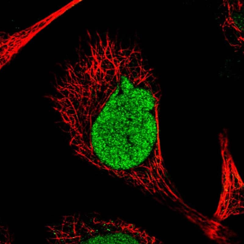 Staining of human cell line A-431 shows localization to nucleus.