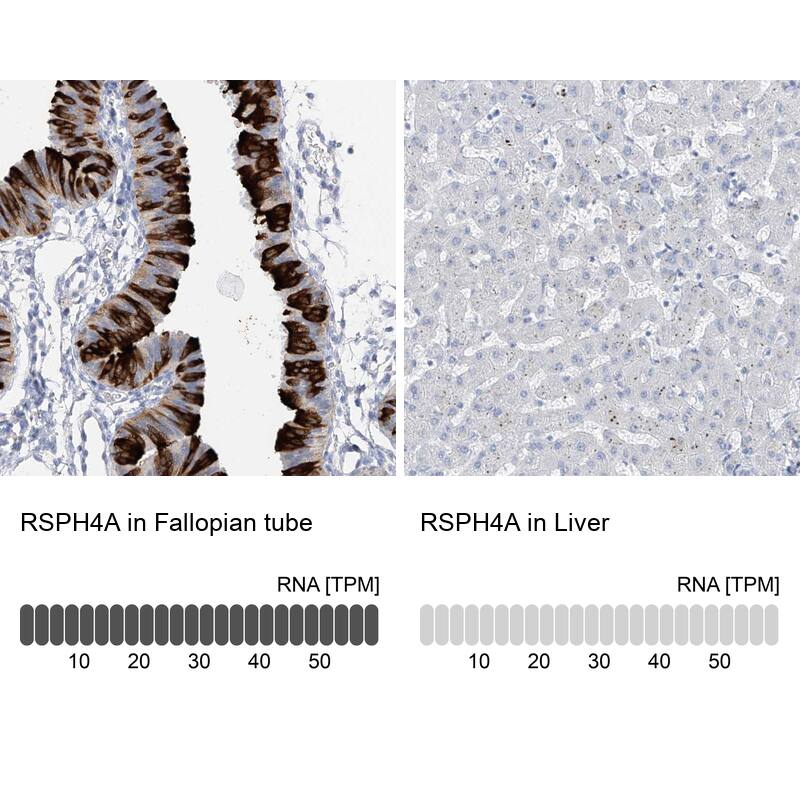 Immunohistochemistry RSPH4A Antibody - BSA Free