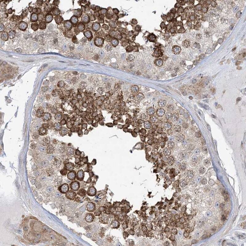 Staining of human testis shows strong cytoplasmic positivity in cells in seminiferus ducts.