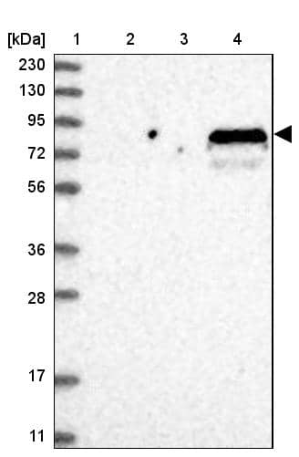 Lane 1: Marker [kDa] 230, 130, 95, 72, 56, 36, 28, 17, 11Lane 2: Human cell line RT-4Lane 3: Human cell line U-251MG spLane 4: Human plasma (IgG/HSA depleted)