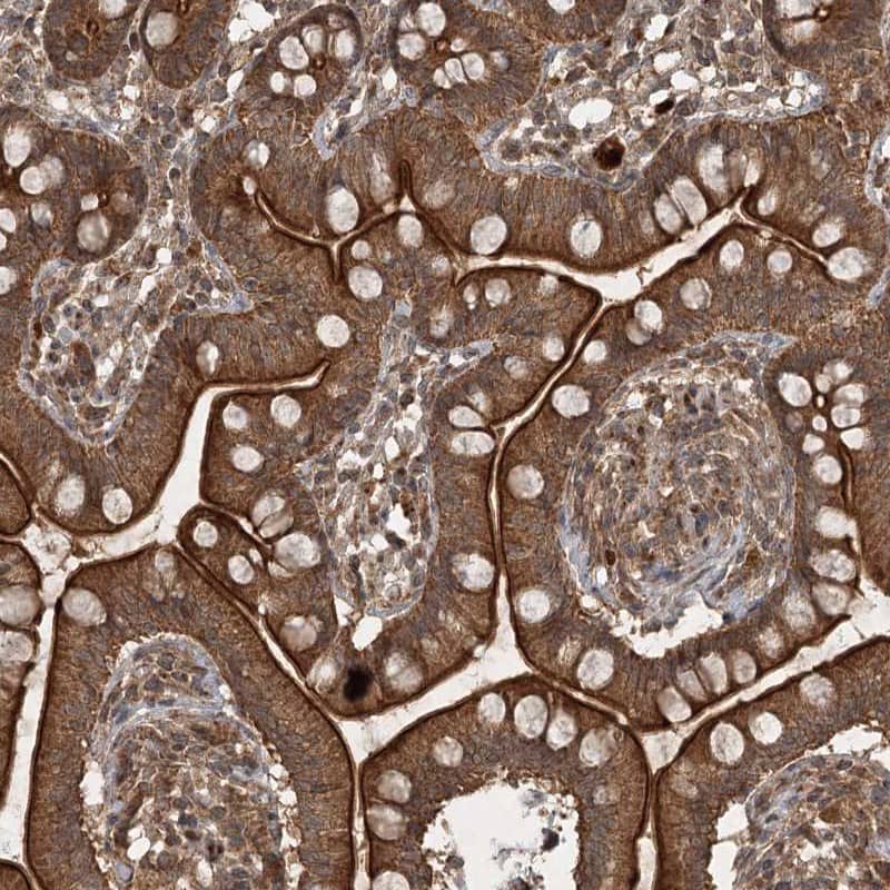 Staining of human small intestine shows strong cytoplasmic and membranous positivity in glandular cells.