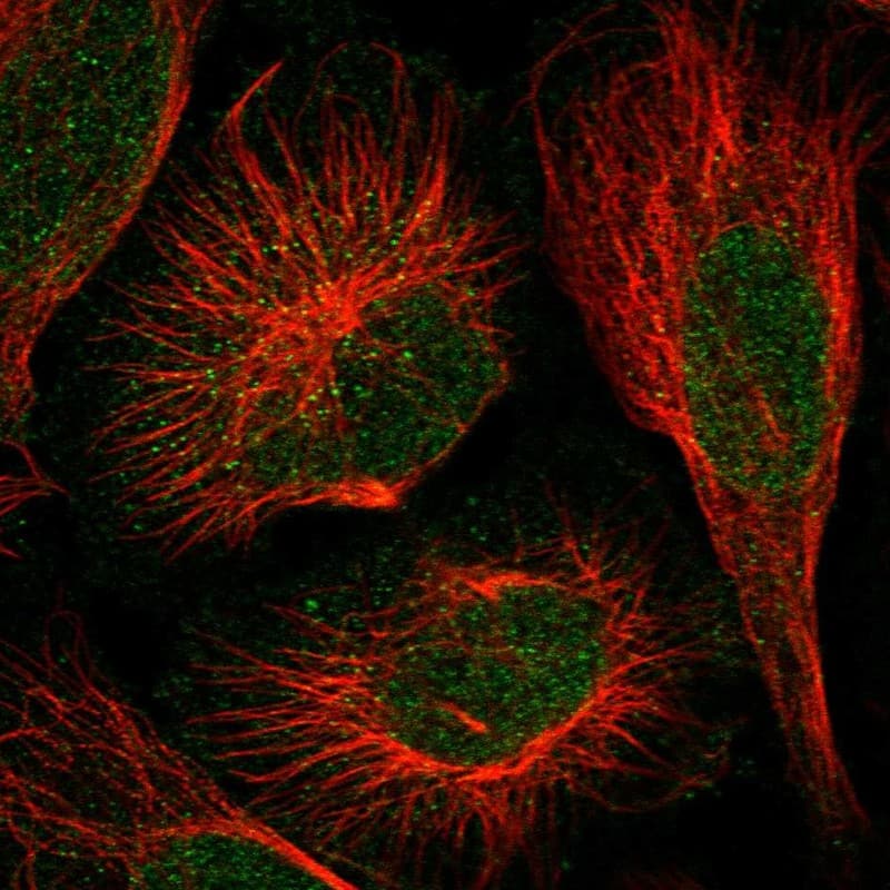 Staining of human cell line U-2 OS shows localization to nucleus & vesicles.