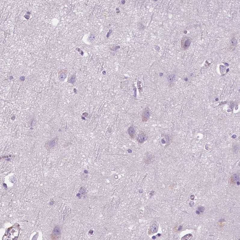Staining of human cerebral cortex shows no positivity in neurons as expected.