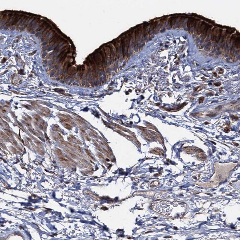 Immunohistochemistry-Paraffin DEPDC4 Antibody - BSA Free